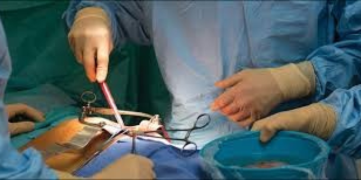 Comprehending Kidney Transplant: Any Lifesaving Method