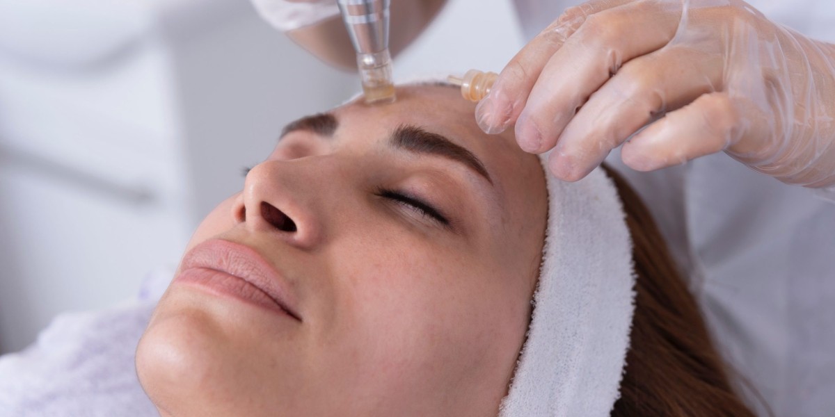 Skin Deep Renewal: The PRP Microneedling Transformation