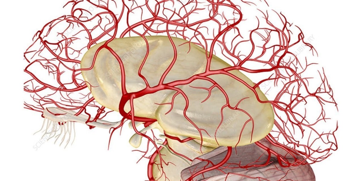 Cerebral Angiography: Cerebral graphy Procedures and Its Vital Role in Diagnosing Brain Disorders