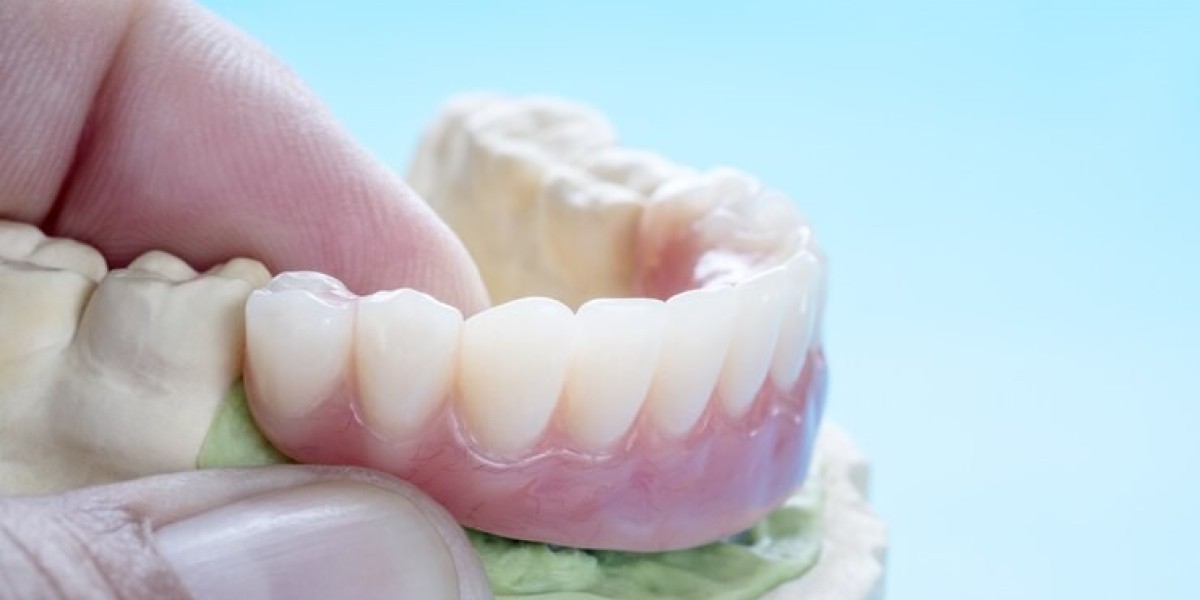 Conserve the Cleanliness of Your Dentures to Thwart the Accretion of Food Particles that May Lead to Stains