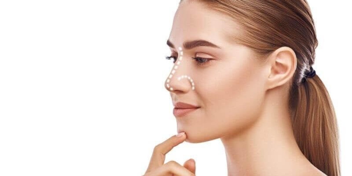 Closed Rhinoplasty: Tailored Solutions for Islamabad’s Diverse Population