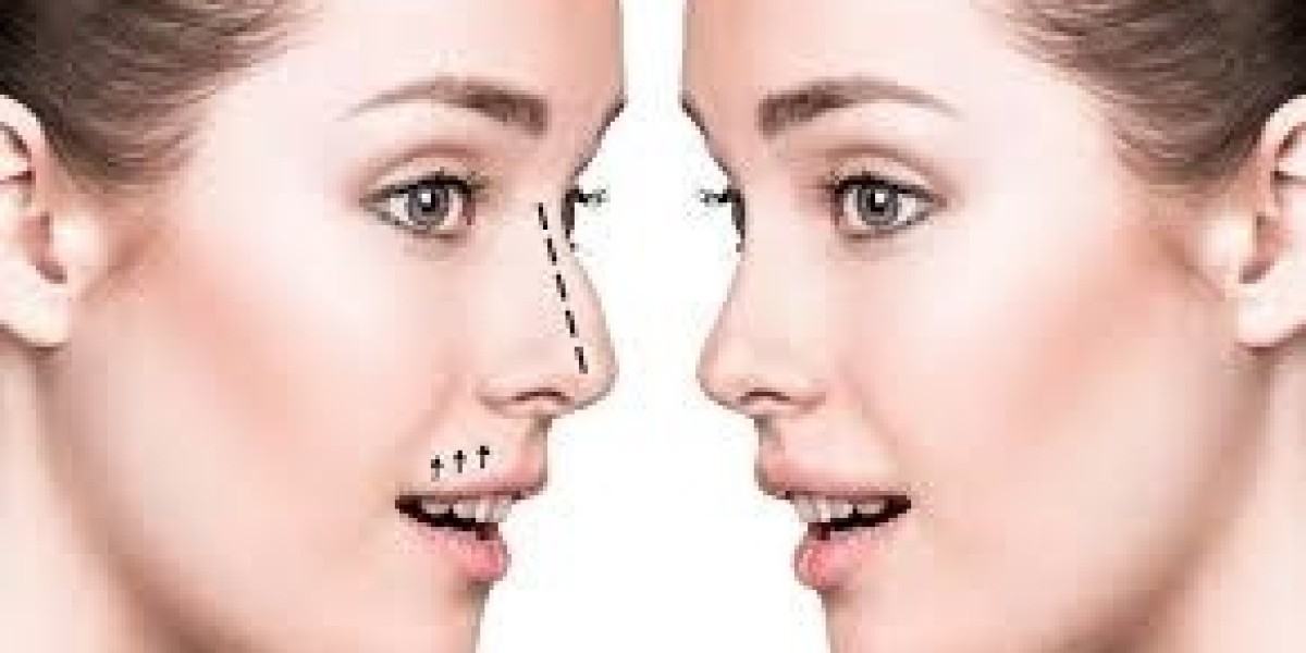 ? The Ultimate Guide to Rhinoplasty Options in Dubai