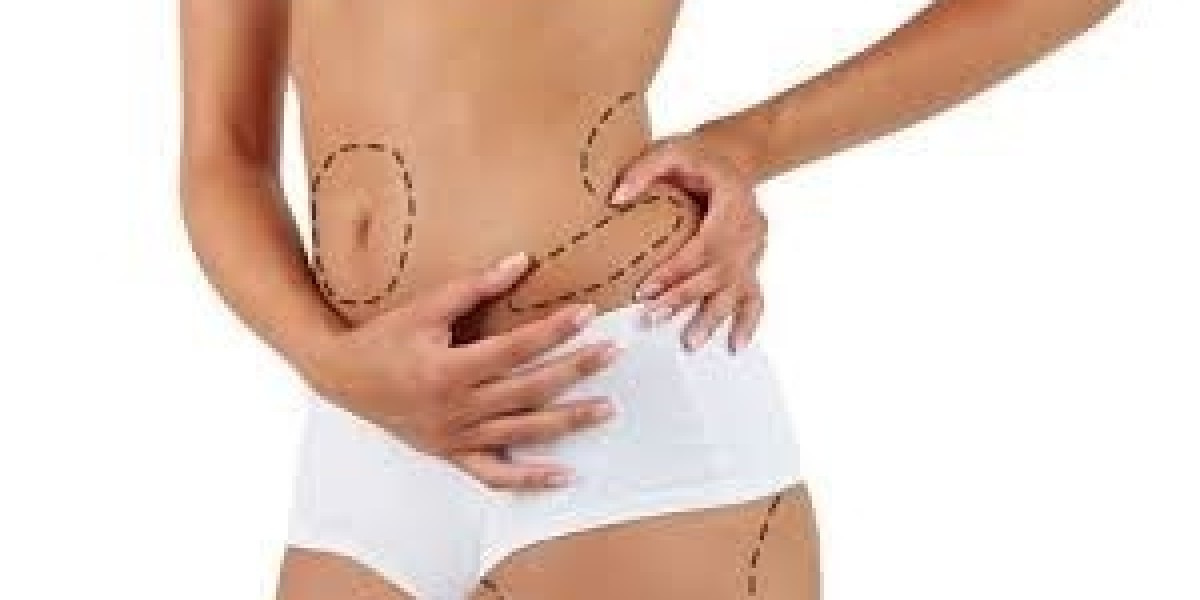 Shape Your Body and Boost Your Confidence with Dubai Liposuction!