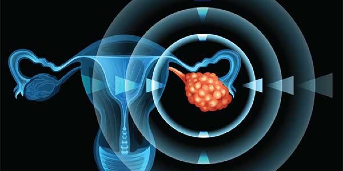 Ovarian Cancer Diagnostic Market is growing at a CAGR of 23.7% in the forecast period 2024-2031