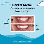 dentalarche