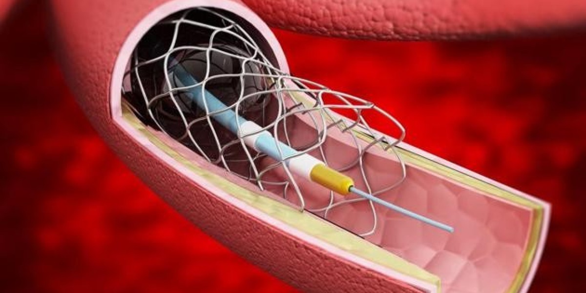 Bare Metal Stents Market Outlook, Growth, Industry Development and Forecast 2024