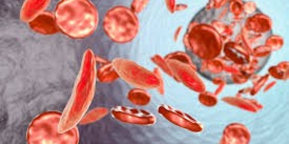 "Singapore Anemia Therapeutics Market: Current Landscape, Key Treatments, and Growth Prospects"