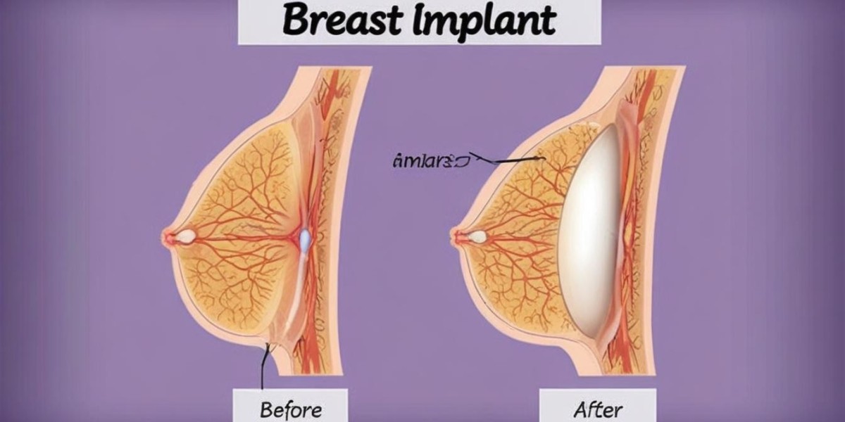 Breast Lift in Turkey: Achieve a Youthful and Firm Bust with Lifeline Turkey