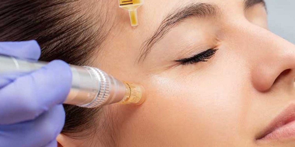 Microneedling and PRP Therapy: The Ultimate Skin Repair Duo in Islamabad