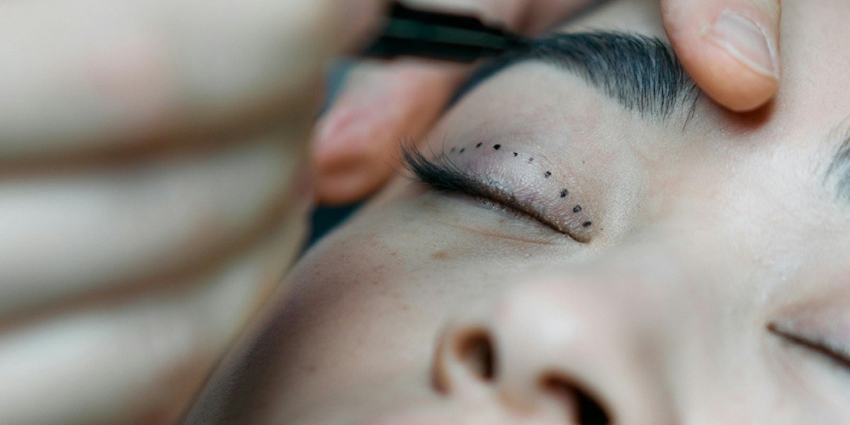 A Step-by-Step Guide to Eyelid Surgery at Glamorous Clinic