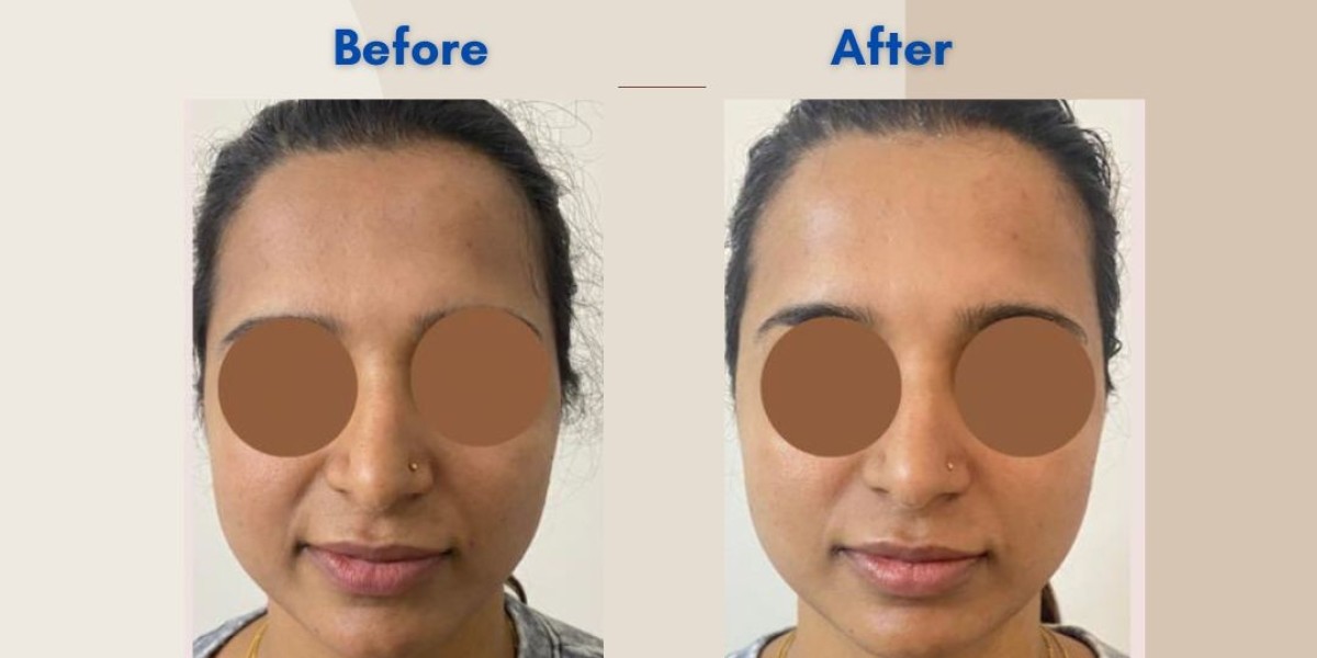 Best skin clinic Near Me in Bangalore