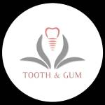 Tooth and Gum